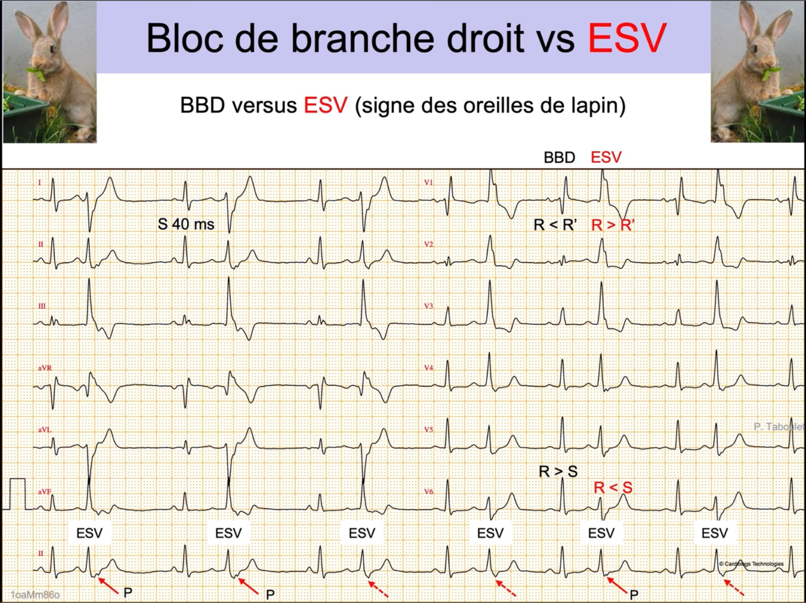 BBD vs ESV — oreilles de lapin