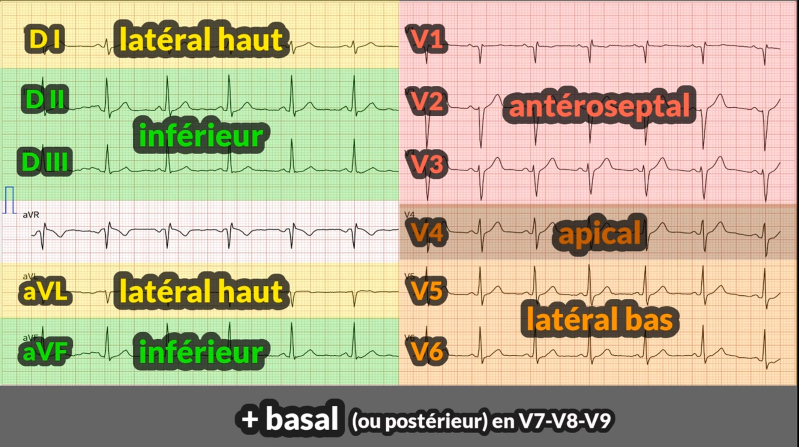 ECG territoires — cartographie des 12 dérivations