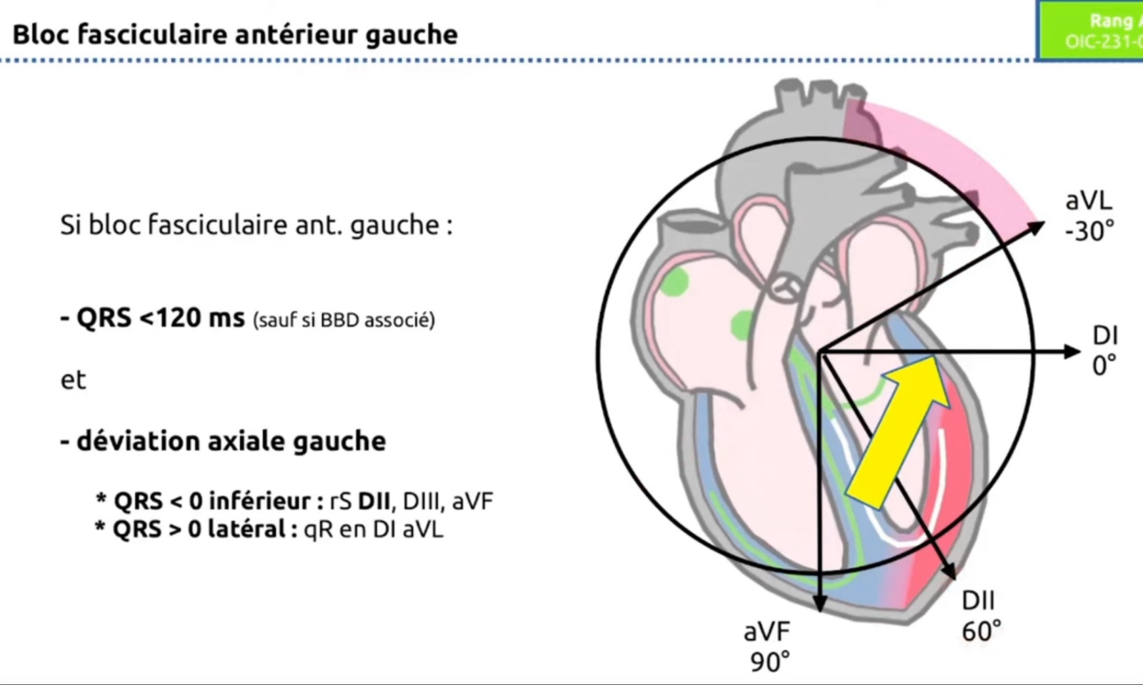 HBAG — schéma vecteur axe gauche