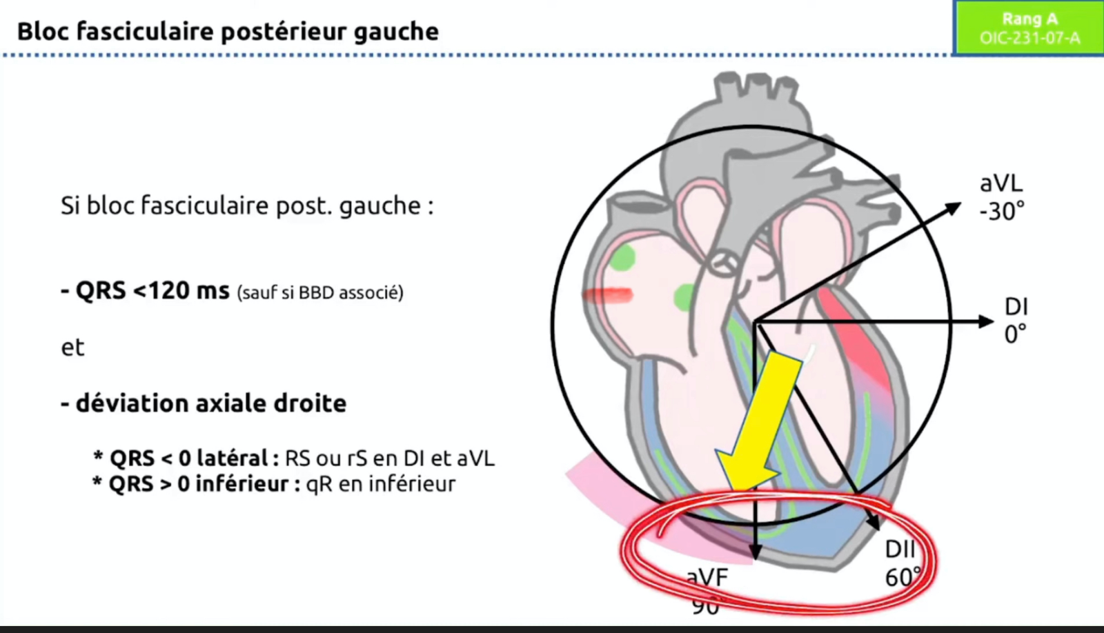 HBPG — schéma vecteur axe droit