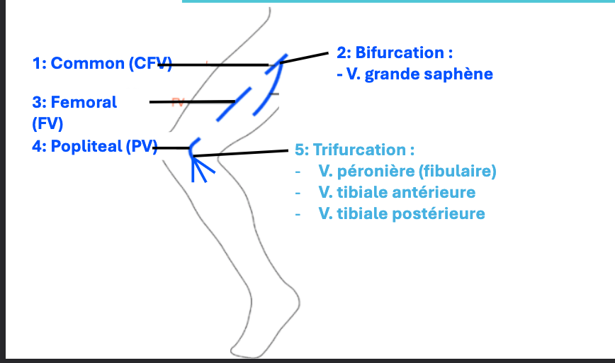 TVP schéma général
